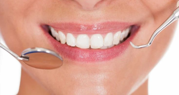 Tooth Reshaping treatment in Jadavpur