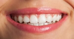 Read more about the article Veneers vs. Crowns: What Are the Pros and Cons of Each?