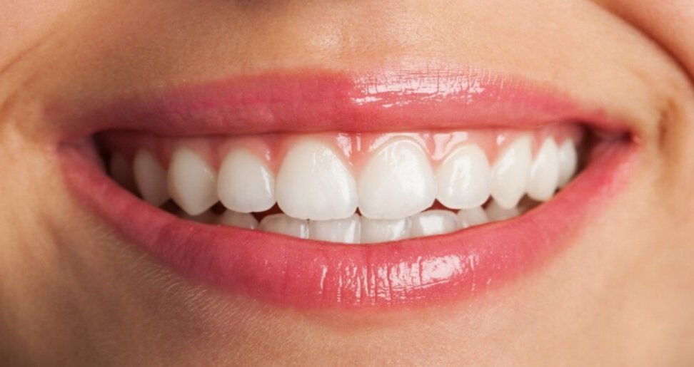 You are currently viewing Veneers vs. Crowns: What Are the Pros and Cons of Each?