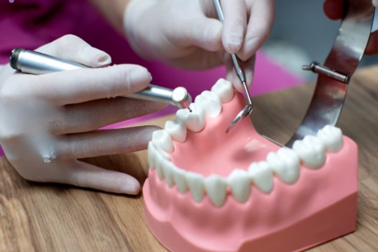 What Is a Single Sitting Root Canal?