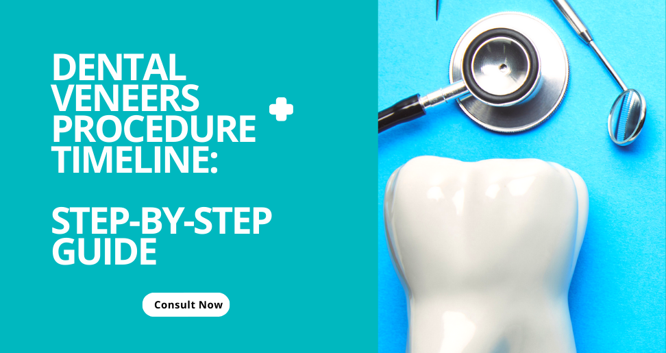 You are currently viewing Dental Veneers Procedure Timeline: Step-by-Step Guide