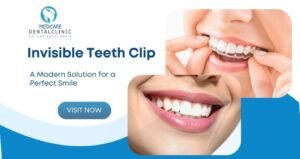 Read more about the article Invisible Teeth Clip: A Modern Solution for a Perfect Smile