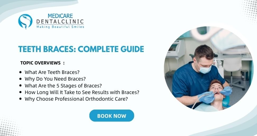 You are currently viewing Teeth Braces: Complete Guide to a Perfect Smile, Treatment Stages & Results