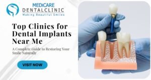 Read more about the article Top Clinics for Dental Implants Near Me: A Complete Guide to Restoring Your Smile Naturally