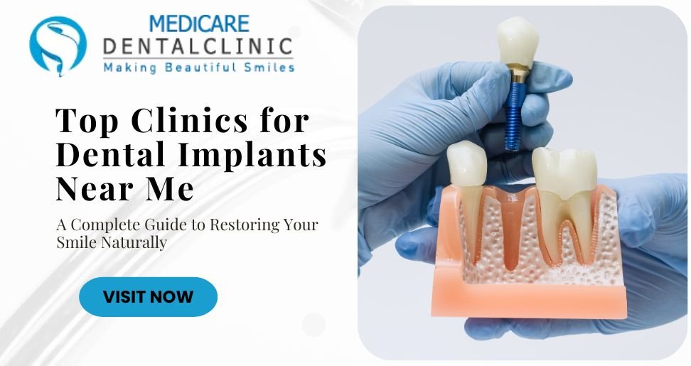 You are currently viewing Top Clinics for Dental Implants Near Me: A Complete Guide to Restoring Your Smile Naturally