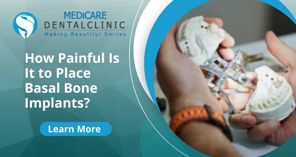 You are currently viewing How Painful Is It to Place Basal Bone Implants?
