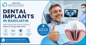 Read more about the article Dental Implants in Baghajatin: Restore Your Smile with Confidence