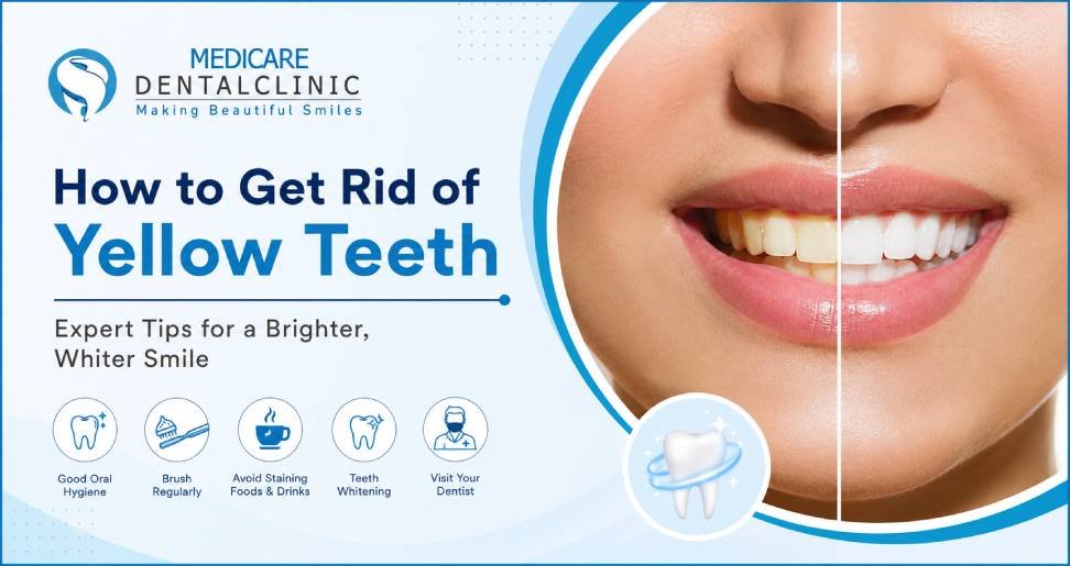 You are currently viewing How to Get Rid of Yellow Teeth: Effective Ways to Brighten Your Smile